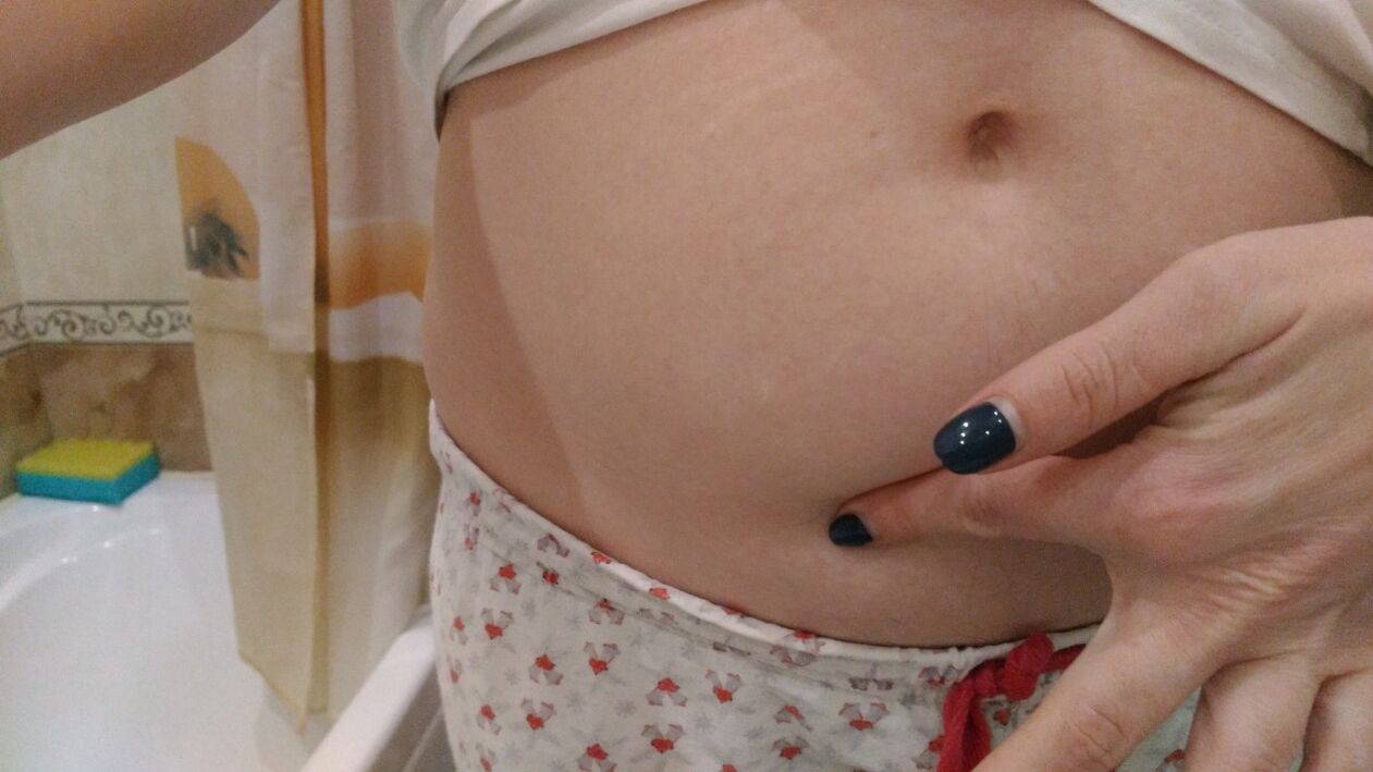 Anzeichen einer Helmintheninfektion aus eigener Erfahrung