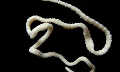 So entfernen Sie Bandwurmparasiten aus dem Körper